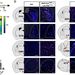 全新天然化合物 BHB-Phe 被發現，可調控身體食欲和體重